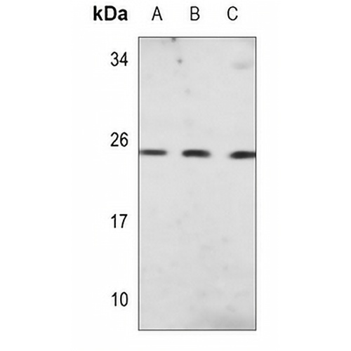 PGP9.5 Mouse Monoclonal Antibody(C3655)