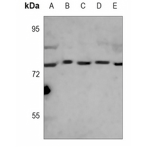 GRP78 Mouse Monoclonal Antibody(C3660)
