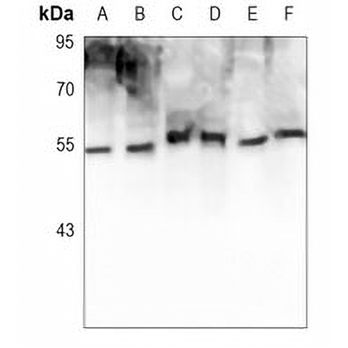 VDR Mouse Monoclonal Antibody(C3666)
