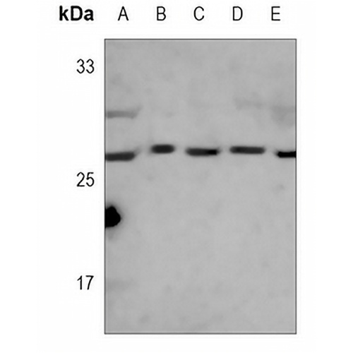 CDK4 Mouse Monoclonal Antibody(C3668)