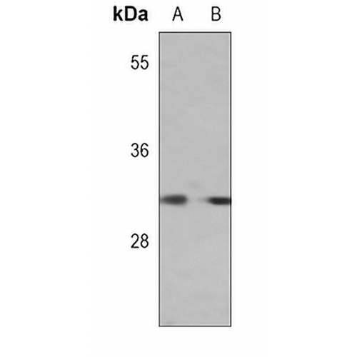 FR beta Mouse Monoclonal Antibody(C3683)