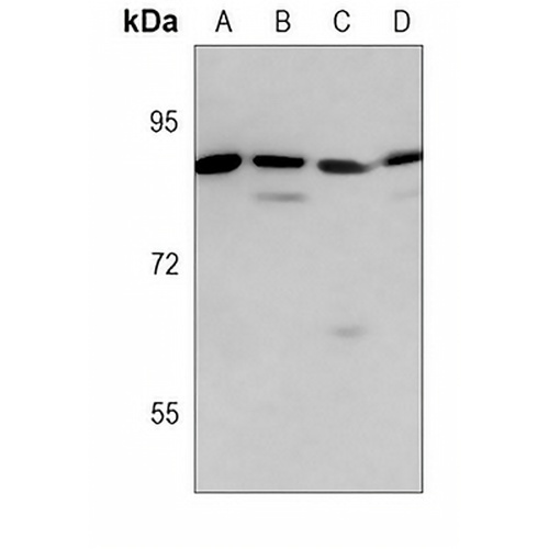 MMP9 Mouse Monoclonal Antibody(C3686)
