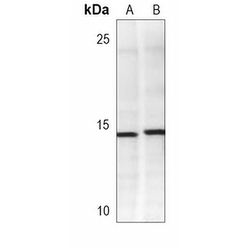 FABP4 Mouse Monoclonal Antibody(C3690)