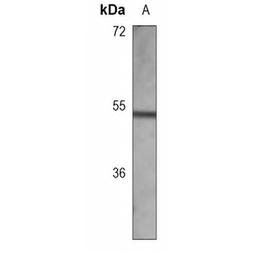 Arylsulfatase A Mouse Monoclonal Antibody(C3693)