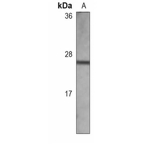 MUC1 Mouse Monoclonal Antibody(C3697)