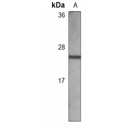 TIMP2 Mouse Monoclonal Antibody(C3698)