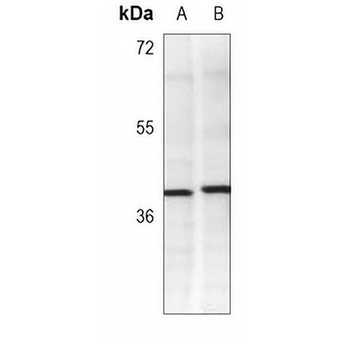 CD326 Mouse Monoclonal Antibody(C3702)