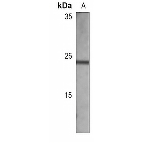 MGMT Mouse Monoclonal Antibody(C3703)
