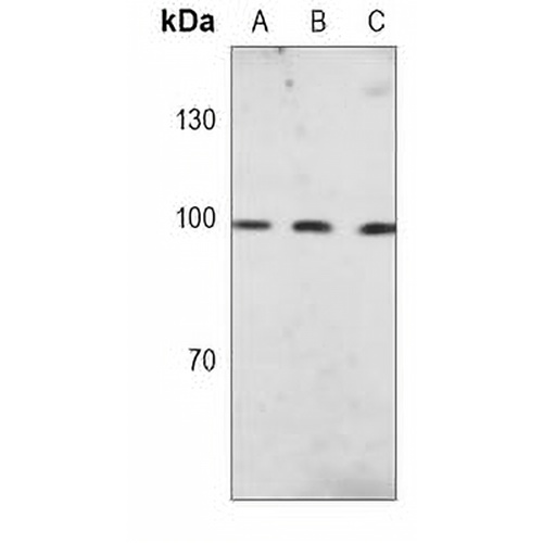 c-FER Mouse Monoclonal Antibody(C3705)