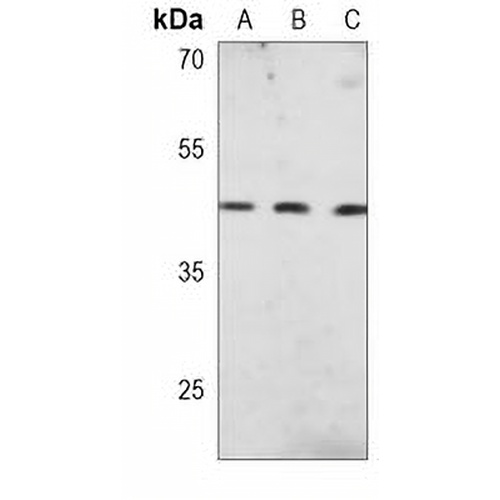 HLA-G Mouse Monoclonal Antibody(C3709)