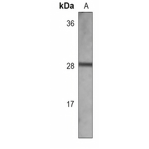 Galectin 3 Mouse Monoclonal Antibody(C3710)