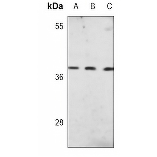 PU.1 Mouse Monoclonal Antibody(C3711)