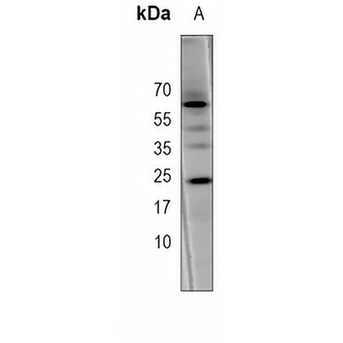 VEGFR1 Mouse Monoclonal Antibody(C3712)