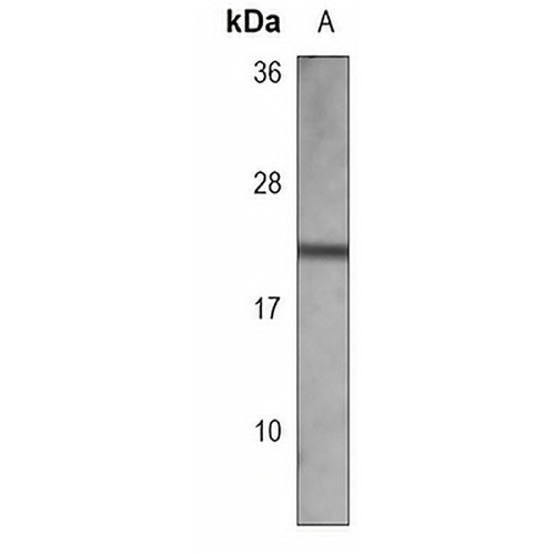 ADCYAP1 Mouse Monoclonal Antibody(C3713)