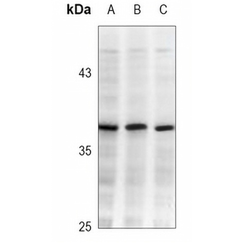 TBP Mouse Monoclonal Antibody(C3718)
