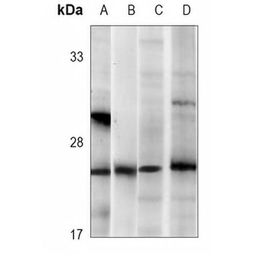 RAB3B Mouse Monoclonal Antibody(C3719)