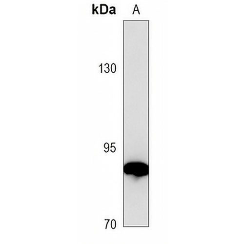 Transglutaminase 2 Mouse Monoclonal Antibody(C3728)
