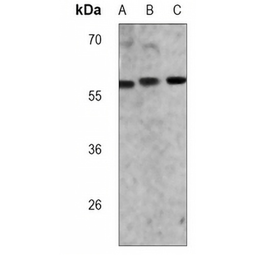ME2 Mouse Monoclonal Antibody(C3735)