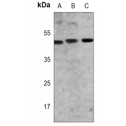 GATA3 Mouse Monoclonal Antibody(C3738)