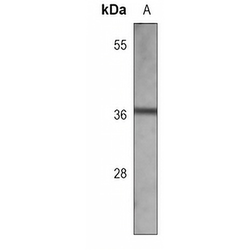 Cyclin D1 Mouse Monoclonal Antibody(C3739)