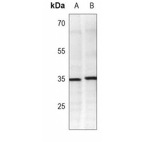 IKB alpha Mouse Monoclonal Antibody(C3745)