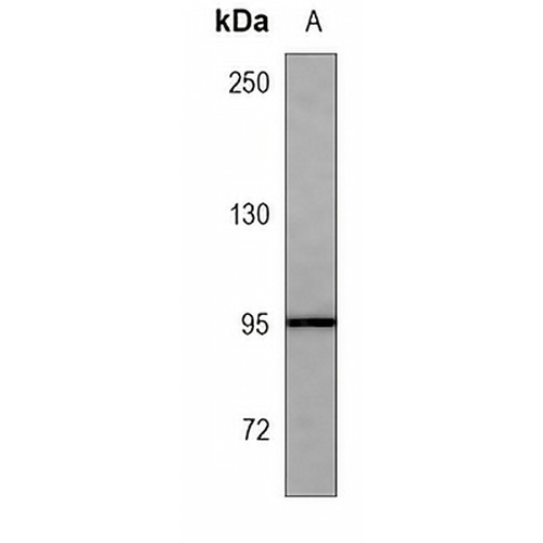 CD30 Mouse Monoclonal Antibody(C3754)