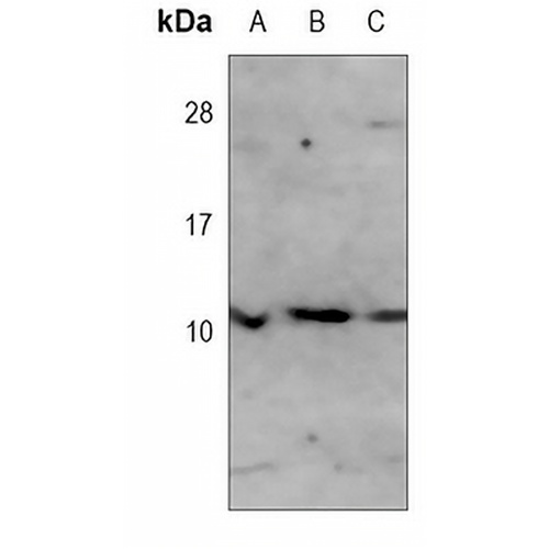 S100-A2 Mouse Monoclonal Antibody(C3755)