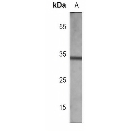 EPHB2 Mouse Monoclonal Antibody(C3757)