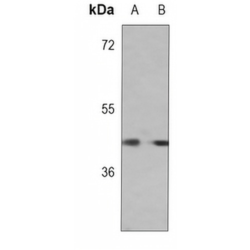 SCCA1 Mouse Monoclonal Antibody(C3759)