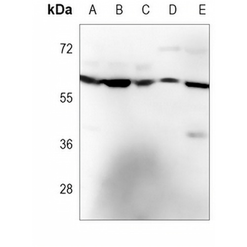PPP2R1B Mouse Monoclonal Antibody(C3760)