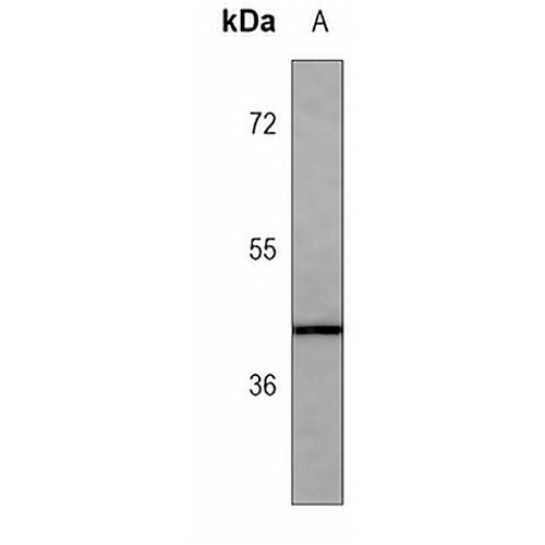 HLA-F Mouse Monoclonal Antibody(C3762)
