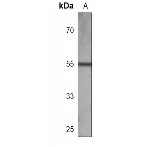 AKT Mouse Monoclonal Antibody(C3763)