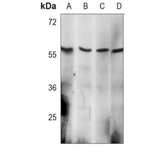 AKT2 Mouse Monoclonal Antibody(C3764)