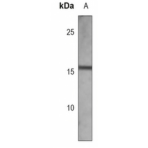 CDA Mouse Monoclonal Antibody(C3767)
