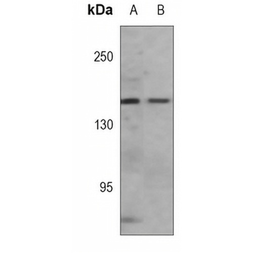 VEGFR3 Mouse Monoclonal Antibody(C3773)