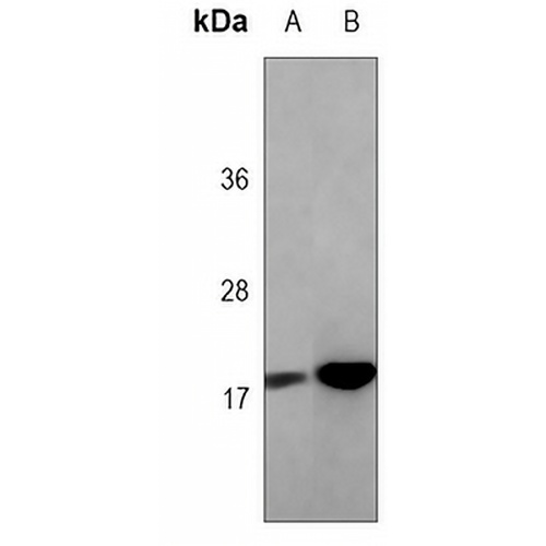 Alpha-synuclein Mouse Monoclonal Antibody(C3778)