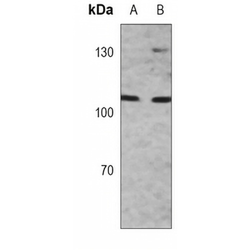 MSH2 Mouse Monoclonal Antibody(C3785)