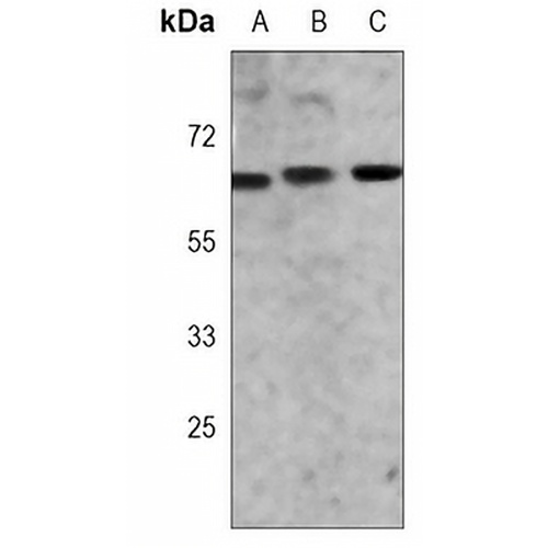 ZAP70 Mouse Monoclonal Antibody(C3786)