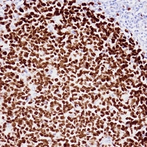 Ki67 Mouse Monoclonal Antibody(C3788)