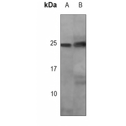 p27 Kip1 Mouse Monoclonal Antibody(C3789)