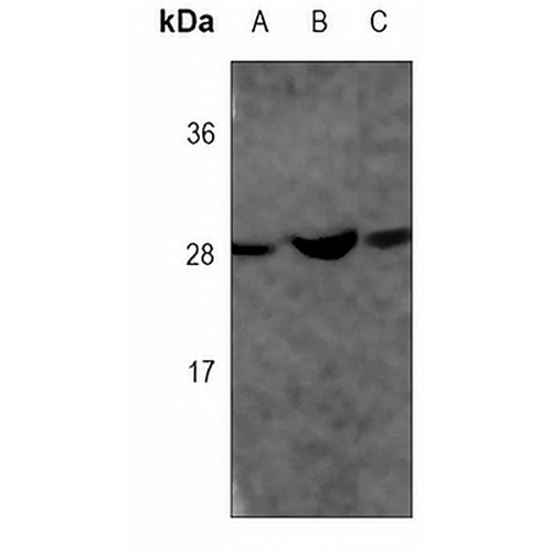 CDX1 Mouse Monoclonal Antibody(C3791)