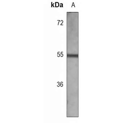 p57 Kip2 Mouse Monoclonal Antibody(C3800)