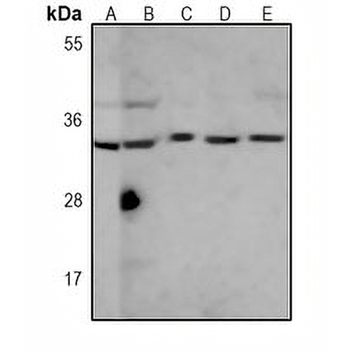SULT1A1 Mouse Monoclonal Antibody(C3802)