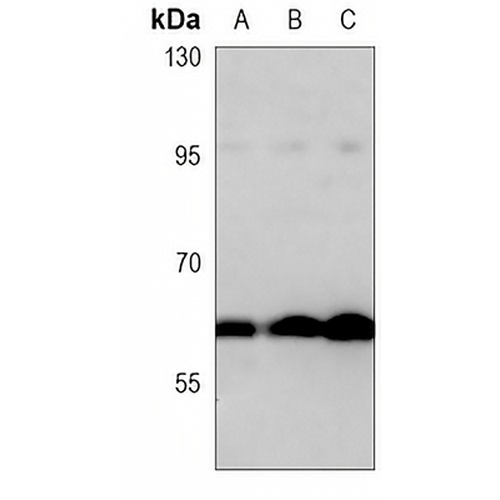 MMP14 Mouse Monoclonal Antibody(C3803)
