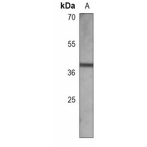 RASSF2 Mouse Monoclonal Antibody(C3805)