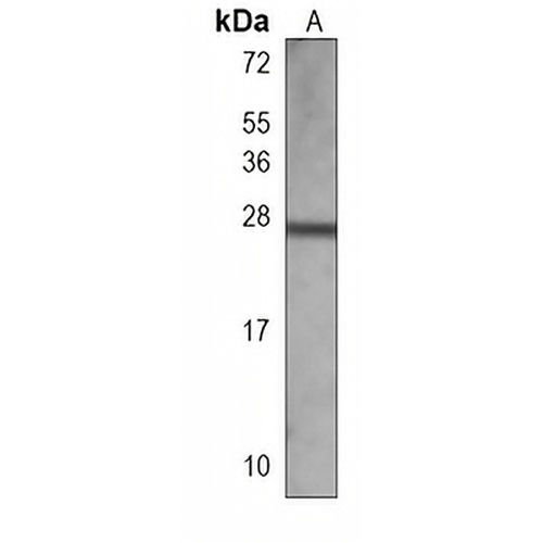 RAB27 Mouse Monoclonal Antibody(C3809)