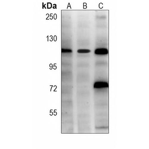 Hexokinase 2 Mouse Monoclonal Antibody(C3814)