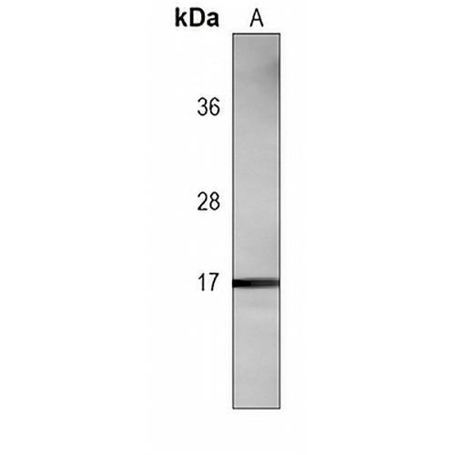 HMGA2 Mouse Monoclonal Antibody(C3815)