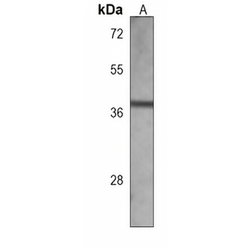 METAP1 Mouse Monoclonal Antibody(C3818)