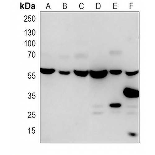 RAD23B Mouse Monoclonal Antibody(C3822)